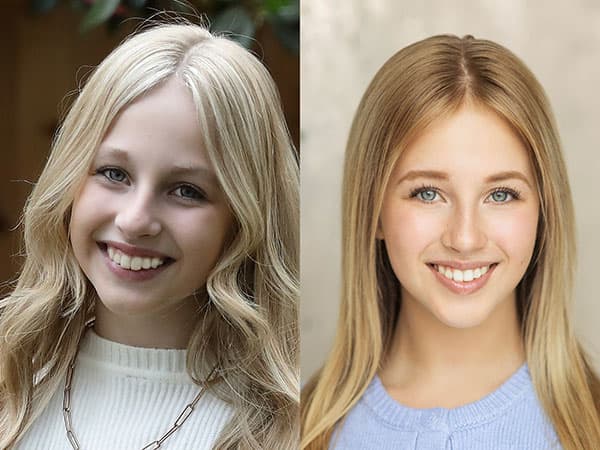 Average Cost of Invisalign® Aligners | Invisalign.com