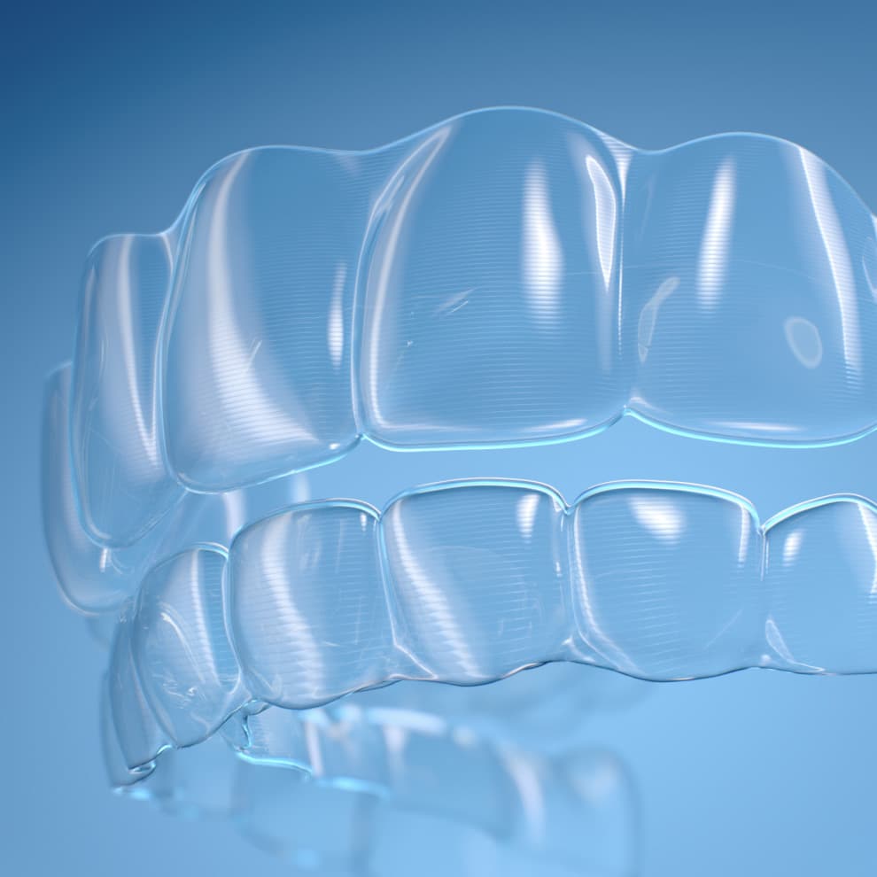 Invisalign Number Why Choose Invisalign® Over Other Aligners | Invisalign.com