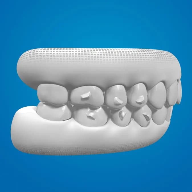 Invisalign® Digital Treatment For Aligners | Invisalign.com