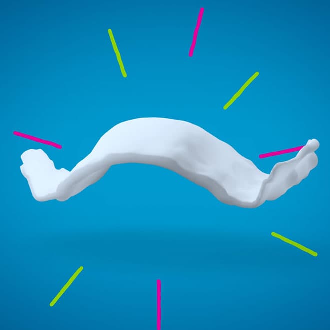 Invisalign® Palatal Expander | Invisalign.com