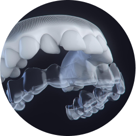 Invisalign® Digital Treatment For Aligners | Invisalign.com