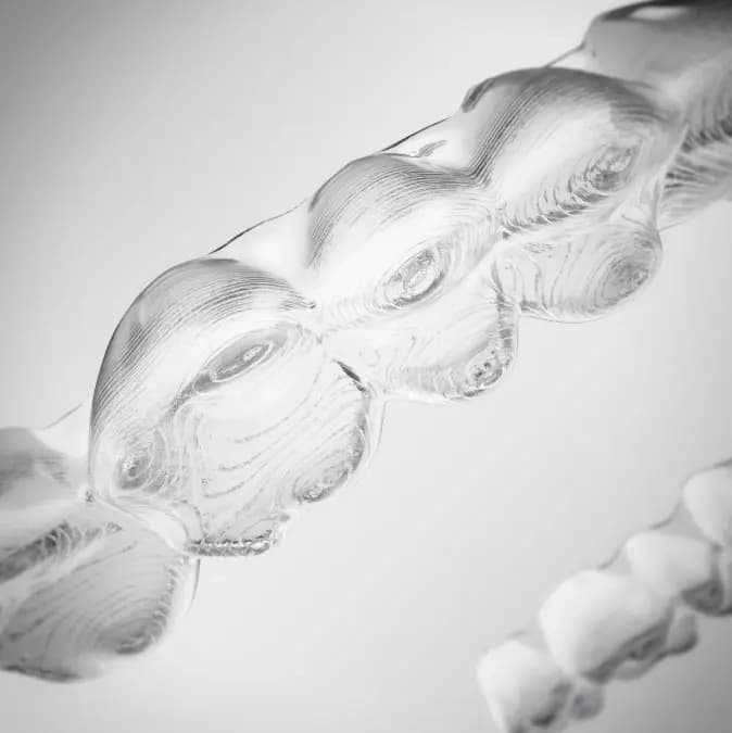 Invisalign® Digital Treatment For Aligners | Invisalign.com