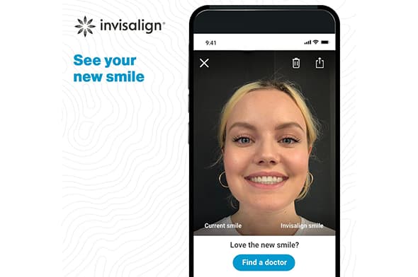 Before and After Cases with Invisalign Treatment