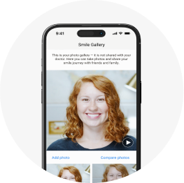 My Invisalign™ App | Invisalign.com